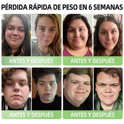 【¡Solo quedan 8!】🛒 ¡Aprovecha un 30% de descuento adicional ahora! 🎉 Probado por expertos en pérdida de peso: alternar entre 4 y 6 pares te ayudará a alcanzar tu figura ideal. 🎊 ¡No te lo pierdas — esta oferta no volverá hasta el próximo año!